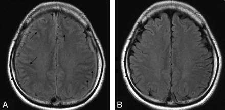 Fig 3.