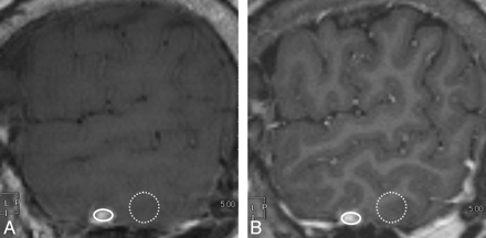 Fig 2.
