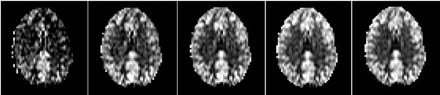Fig 4.
