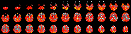 Fig 3.