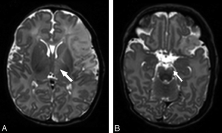 Fig 6.