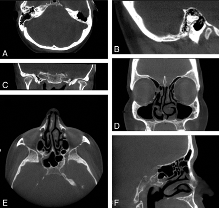 Fig 3.