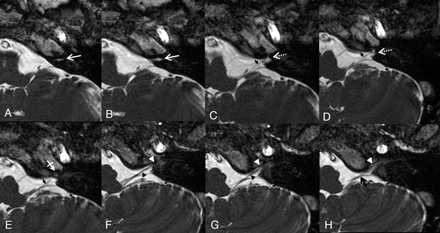 Fig 3.