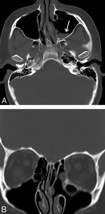 Fig 1.