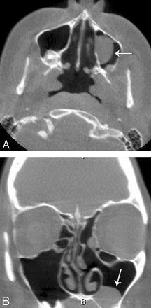 Fig 2.