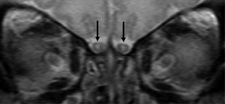 Fig 1.