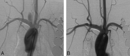 Fig 2.