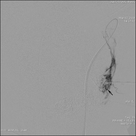 Fig 5.