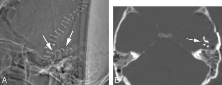 Fig 1.