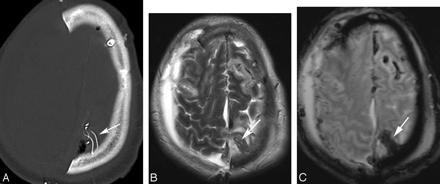 Fig 3.