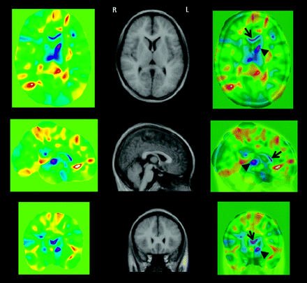 Fig 3.