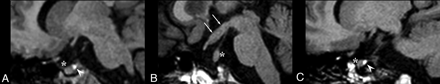 Fig 2.