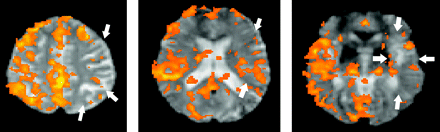 Fig 2.