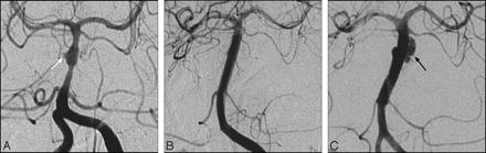 Fig 3.