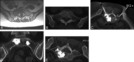   Fig 1. 
