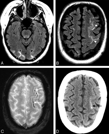 Fig 2.