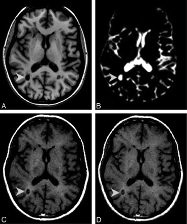 Fig 1.