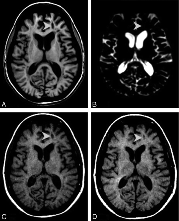 Fig 2.