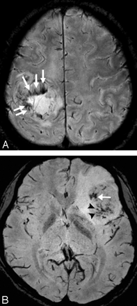 Fig 1.