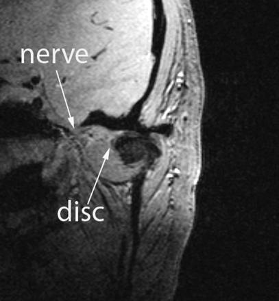 Fig 2.