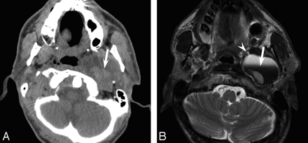 Fig 2.
