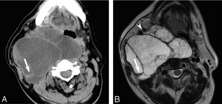 Fig 3.