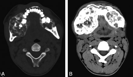   Fig 1. 
