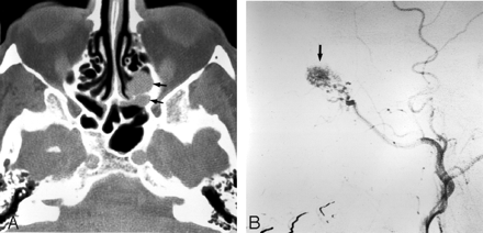 Fig 10.