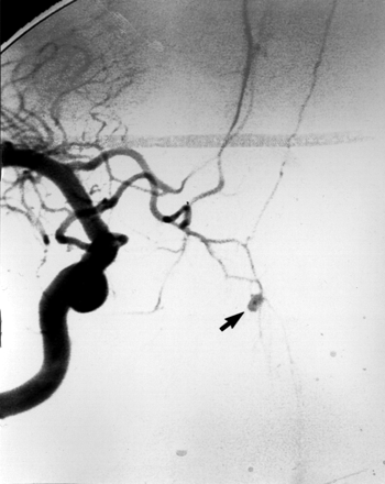 Fig 2.