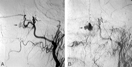 Fig 5.