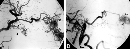 Fig 6.