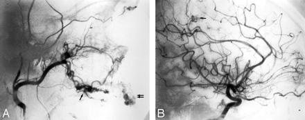Fig 8.