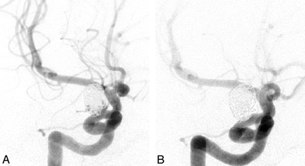 Fig 1.
