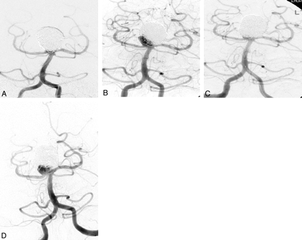 Fig 5.