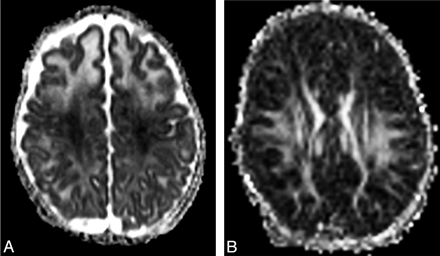 Fig 1.