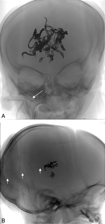 Fig 4.