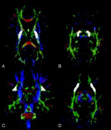 Fig 2.