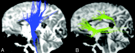 Fig 3.