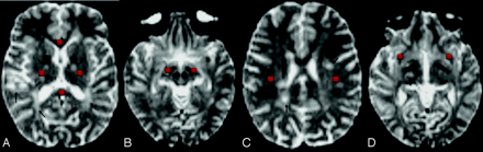 Fig 4.