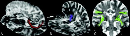 Fig 5.