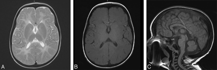Fig 2.