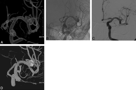 Fig 2.