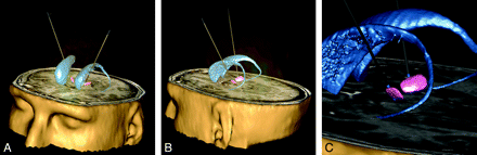 Fig 1.