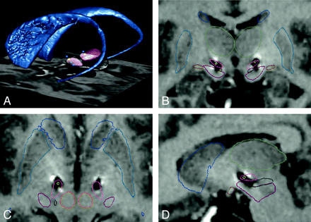 Fig 3.