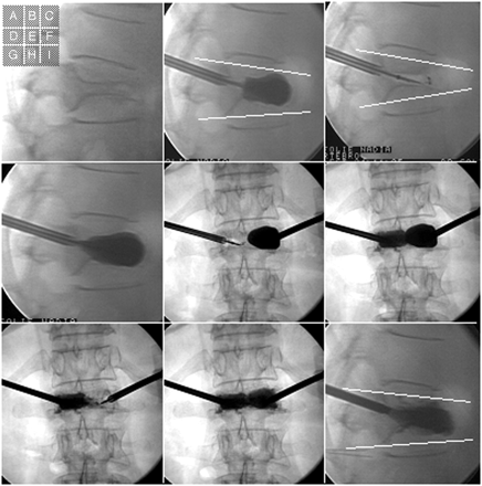 Fig 3.