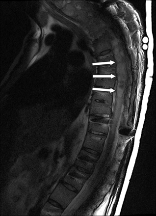 Fig 2.