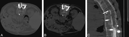 Fig 3.