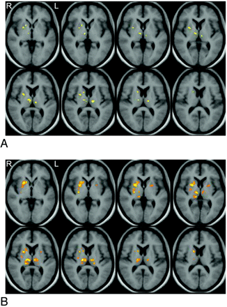 Fig 1.