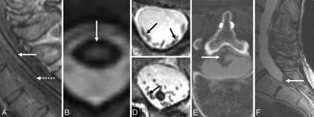 Fig 3.