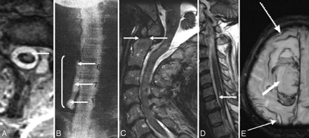 Fig 8.